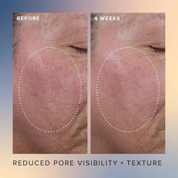 Farmacy Honey Glow 17% Resurfacing Acid Seurum - Picture 4 of 6